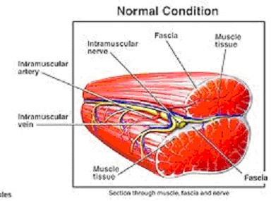 normal muscle-no pain